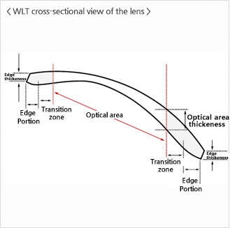 WLT cross-sectional view of the lens